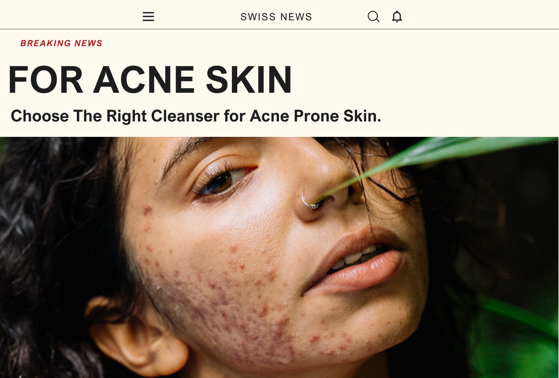 Choosing The Right Cleanser For Acne-Prone Skin