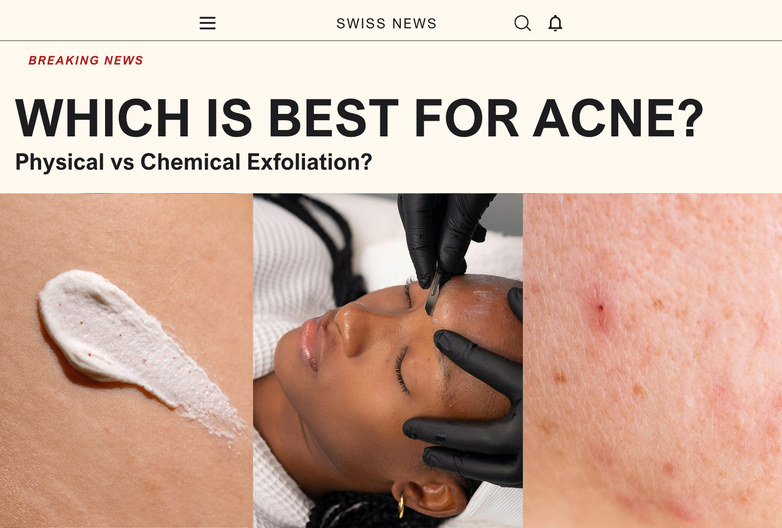 Physical vs Chemical Exfoliation: Which Is Best For Acne Skin?