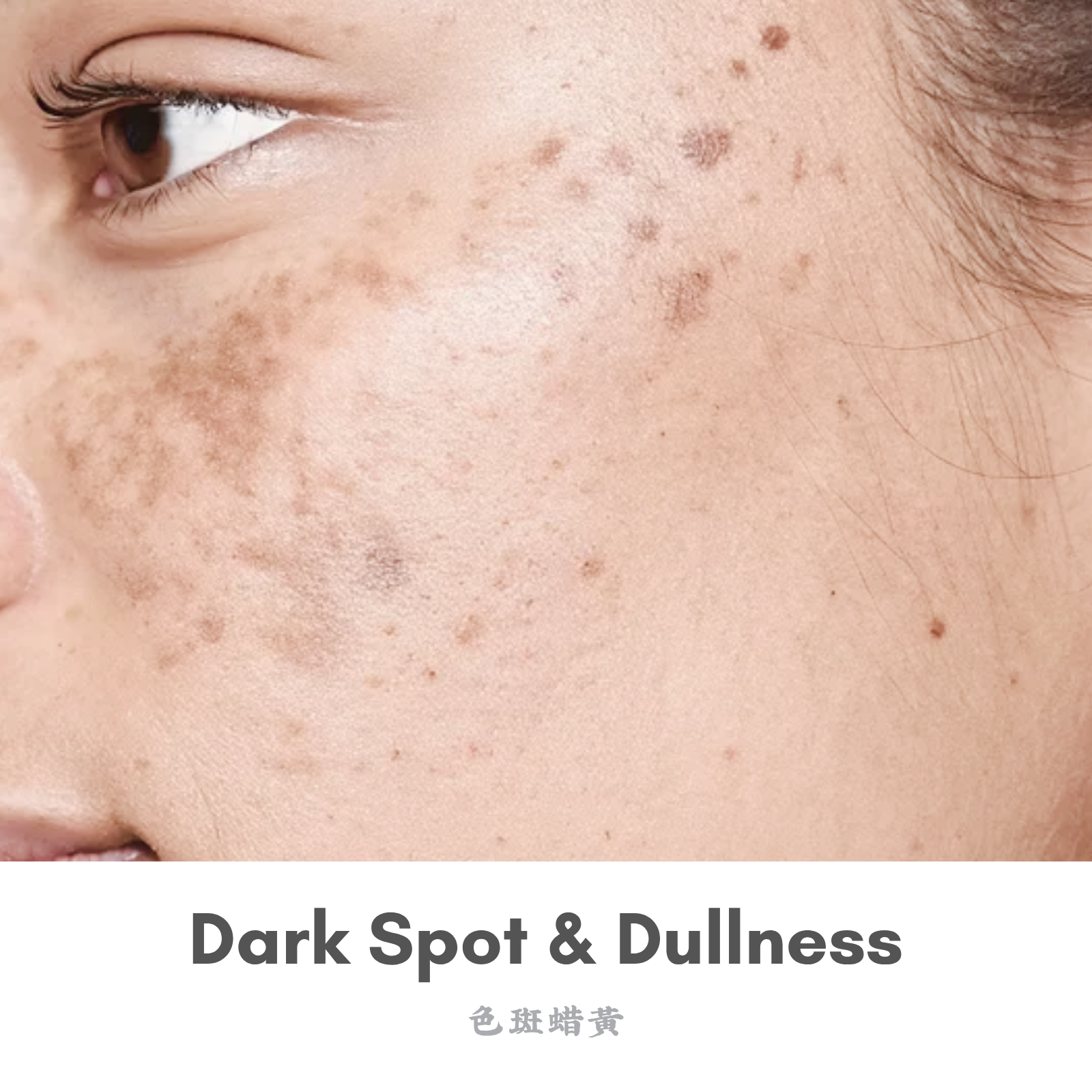 Dark Spot & Dullness – ALLYOUNG INTERNATIONAL (MALAYSIA) SDN BHD