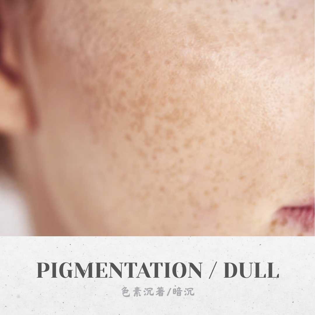 Pigmentation / Dull Skin