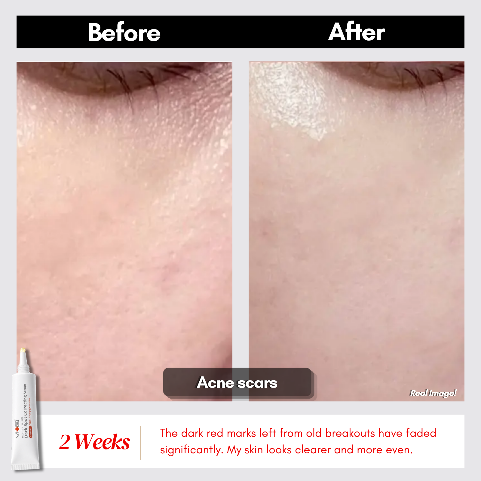 【Buy 1 Free 1】Dark Spot Duo - Swissvita Dark Spot Correcting Serum (15g) x 2pcs
