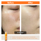 【40% OFF】Super Bright - Swissvita Extreme Vitamin Tri-Effect Serum (30ml) x 2