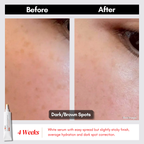 【Buy 1 Free 1】Dark Spot Duo - Swissvita Dark Spot Correcting Serum (15g) x 2pcs