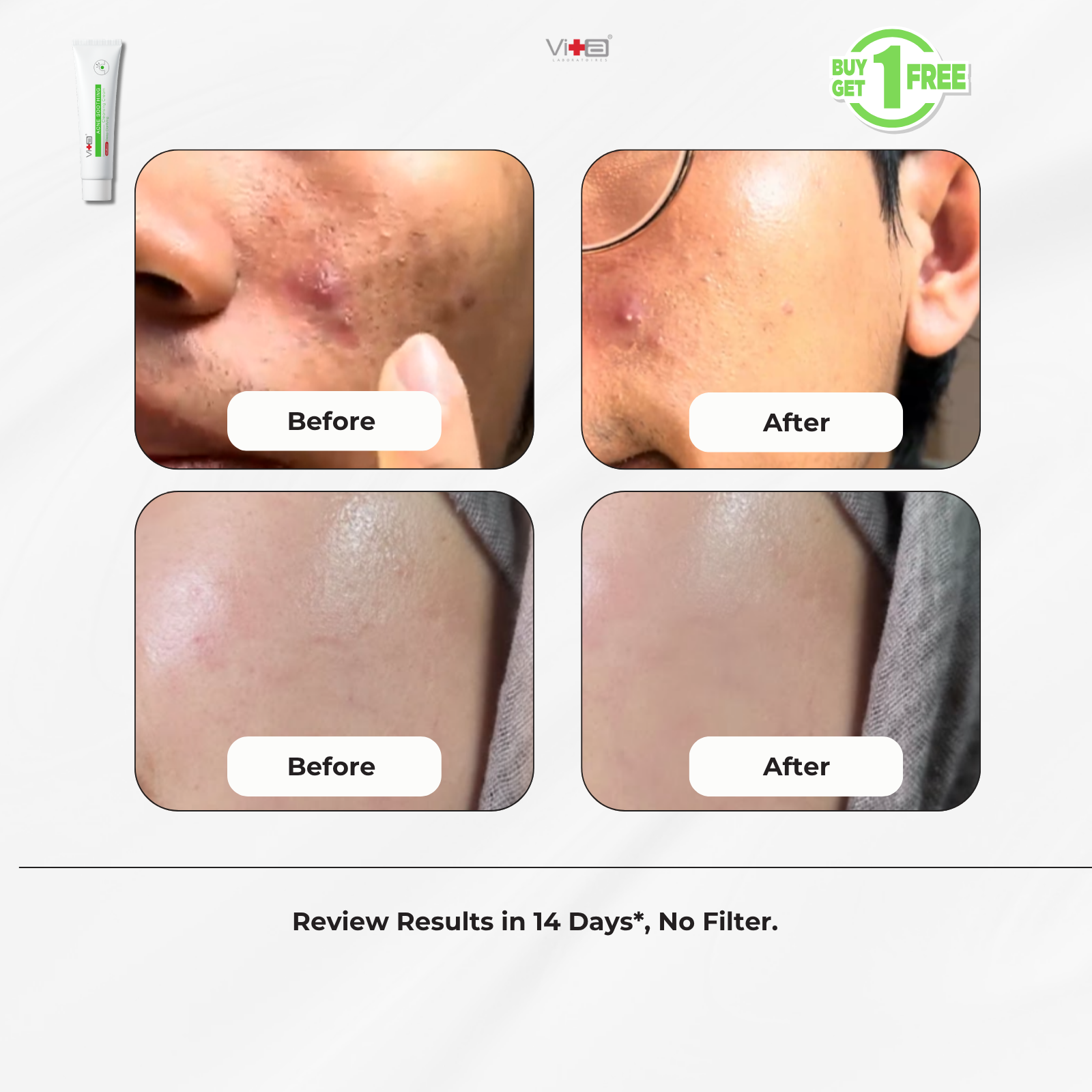 【Buy 1 Free 1】Swissvita Acne Soothing Cleansing Cream 100g x 2pcs