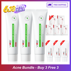 【Buy 3 Free 3】Breakout-Free Bundle - Swissvita Acne Soothing Cleansing Cream (100g) x 3 + Mini Cleanser (30g) x 3