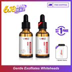 【买一送一】Swissvita Mandelic Acid Perfect Ratio Complex Serum - 30ml (VitaBtech) 薇佳蜜花酸晶焕肤美白精萃(VitaBtech升级版) 30ml