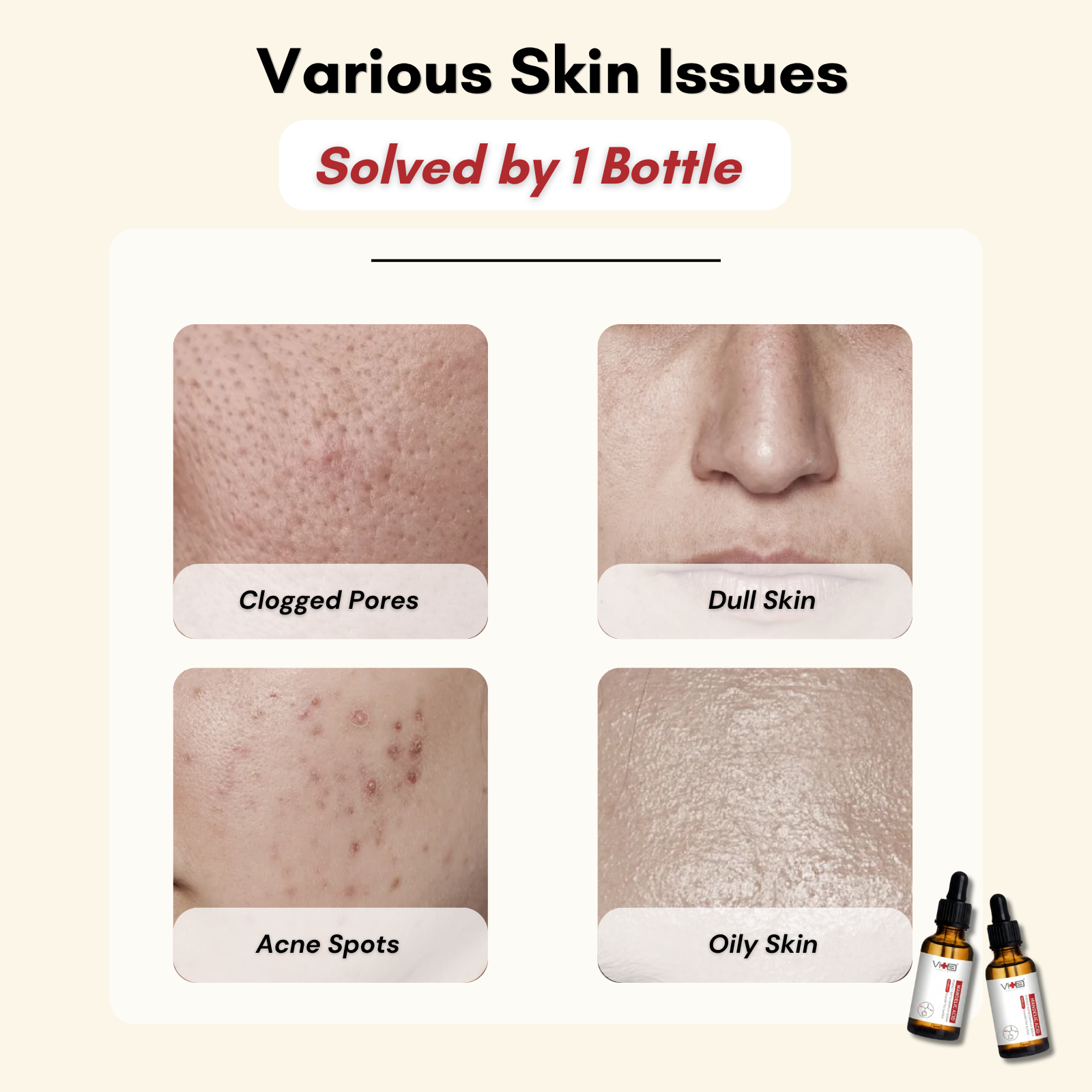 Swissvita Mandelic Acid Serum (30ml)