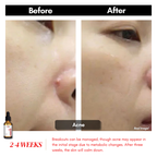 【买一送一】Swissvita Mandelic Acid Perfect Ratio Complex Serum - 30ml (VitaBtech) 薇佳蜜花酸晶焕肤美白精萃(VitaBtech升级版) 30ml