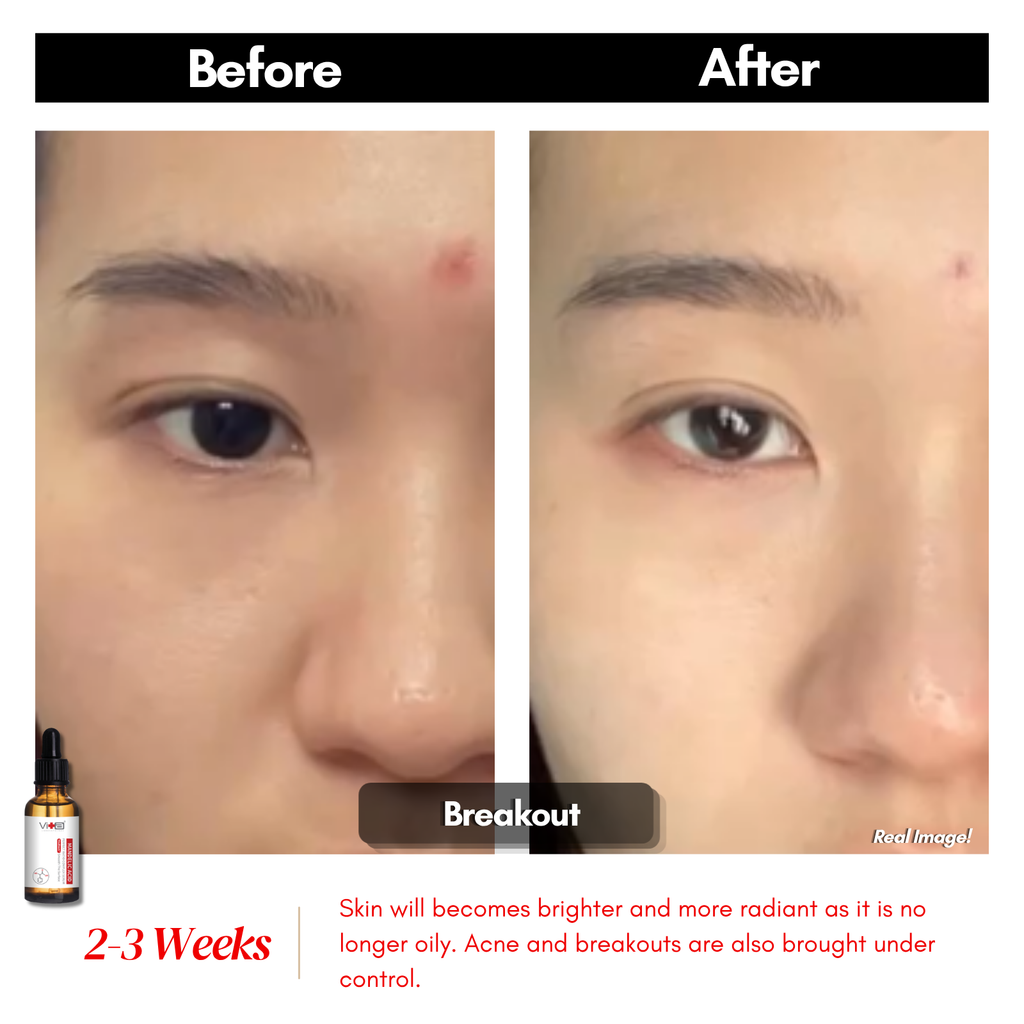 【买一送一】Swissvita Mandelic Acid Perfect Ratio Complex Serum - 30ml (VitaBtech) 薇佳蜜花酸晶焕肤美白精萃(VitaBtech升级版) 30ml