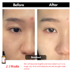 【买一送一】Swissvita Mandelic Acid Perfect Ratio Complex Serum - 30ml (VitaBtech) 薇佳蜜花酸晶焕肤美白精萃(VitaBtech升级版) 30ml