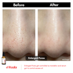 【买一送一】Swissvita Mandelic Acid Perfect Ratio Complex Serum - 30ml (VitaBtech) 薇佳蜜花酸晶焕肤美白精萃(VitaBtech升级版) 30ml