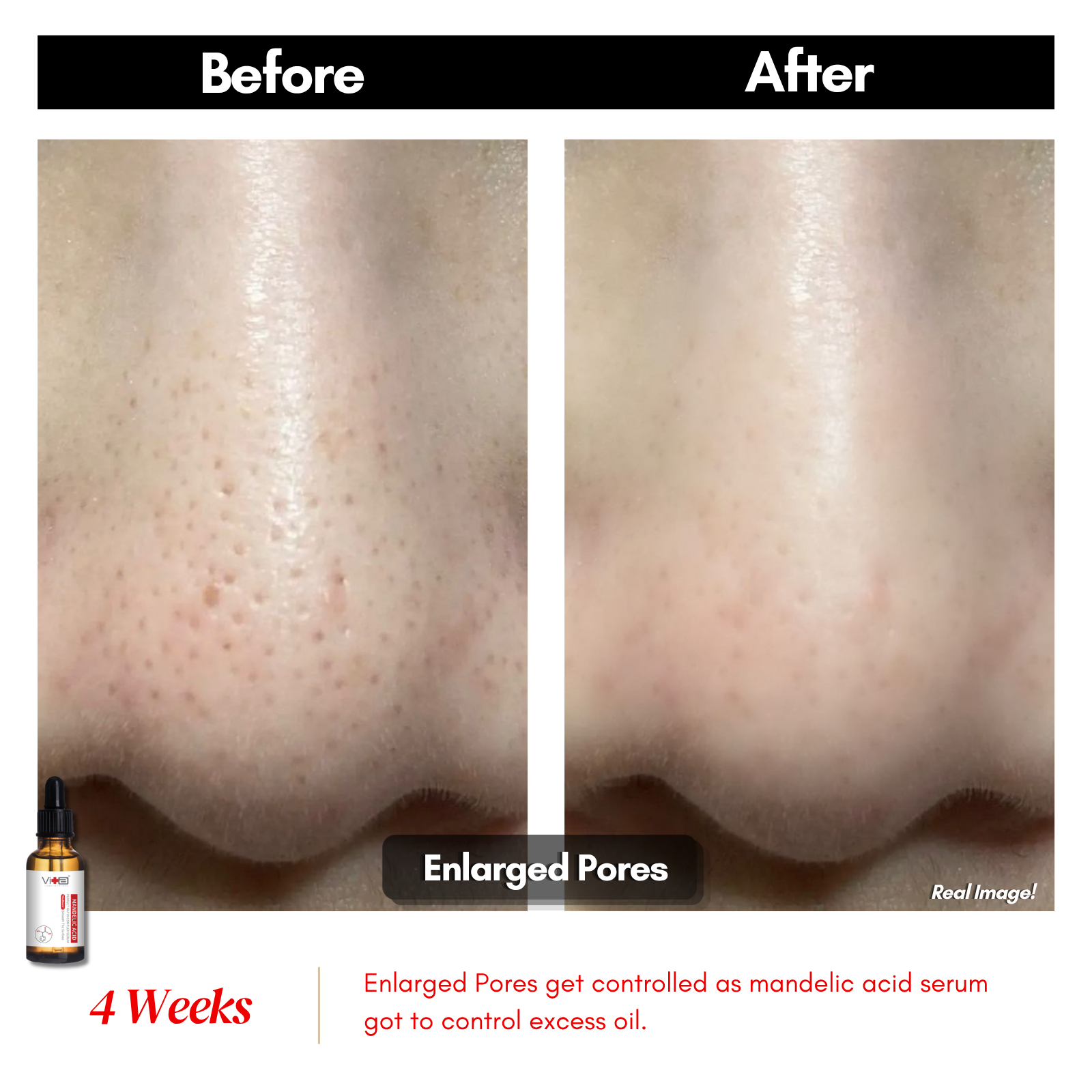 【买一送一】Swissvita Mandelic Acid Perfect Ratio Complex Serum - 30ml (VitaBtech) 薇佳蜜花酸晶焕肤美白精萃(VitaBtech升级版) 30ml