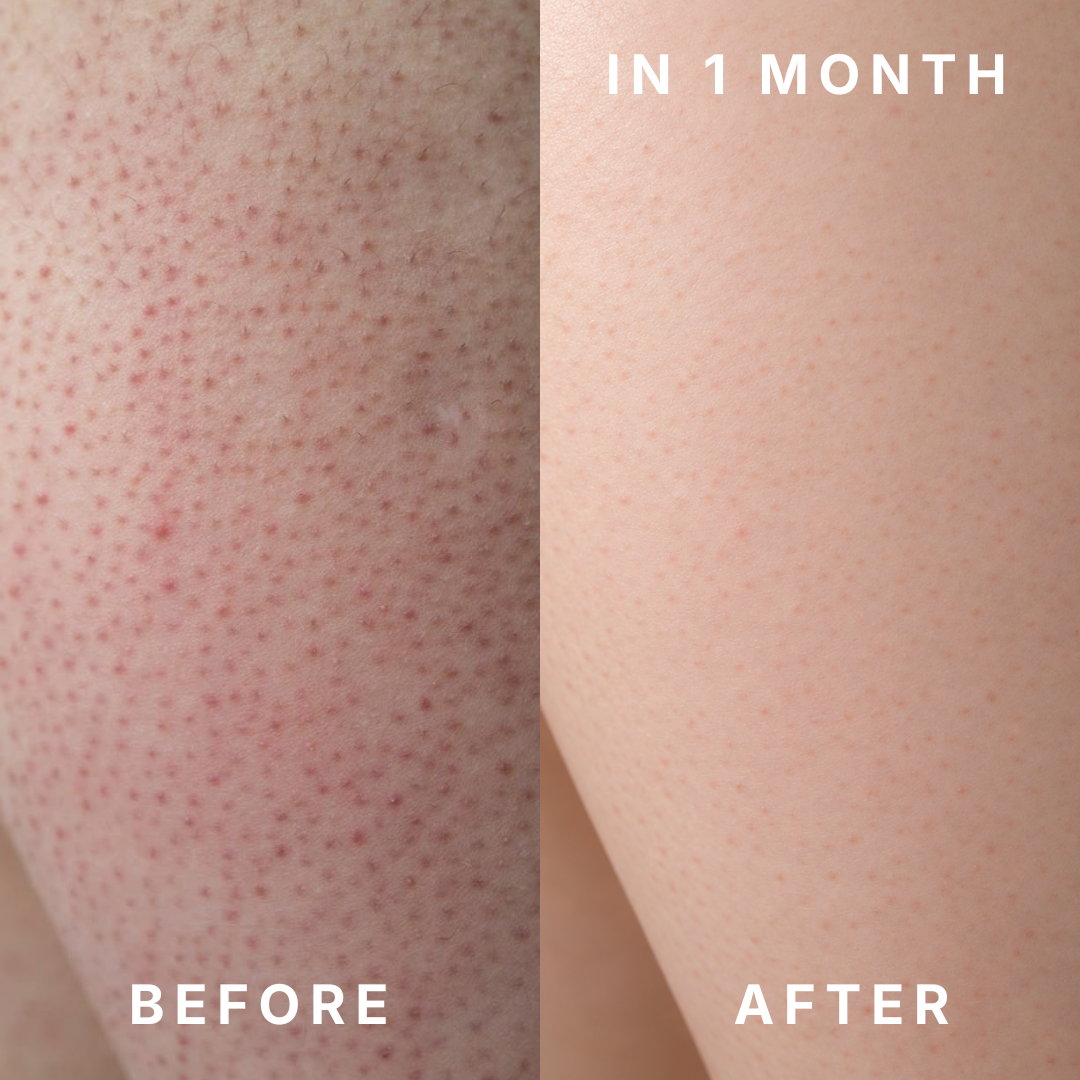 Swissvita 2% Mandelic Acid + Bha Body Treatment (150ml) ALLYOUNG INTERNATIONAL (MALAYSIA) SDN BHD