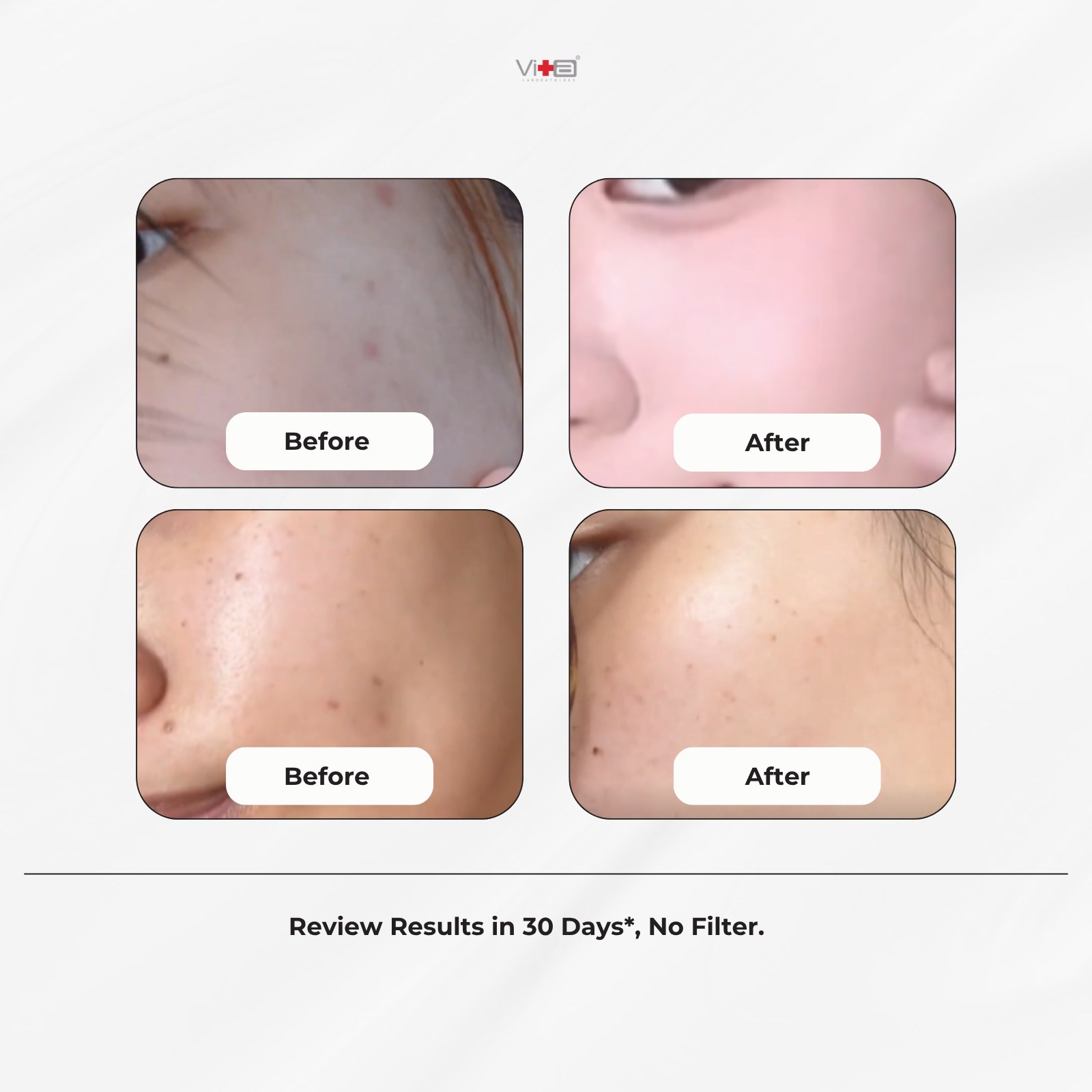 【Buy 1 Free 1】Swissvita Mandelic Acid Facial Polishing Cleansing Cream 100ml x 2 pcs