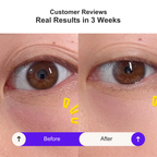 【新品上市】Swissvita 视黄醇焕颜眼霜（15毫升）