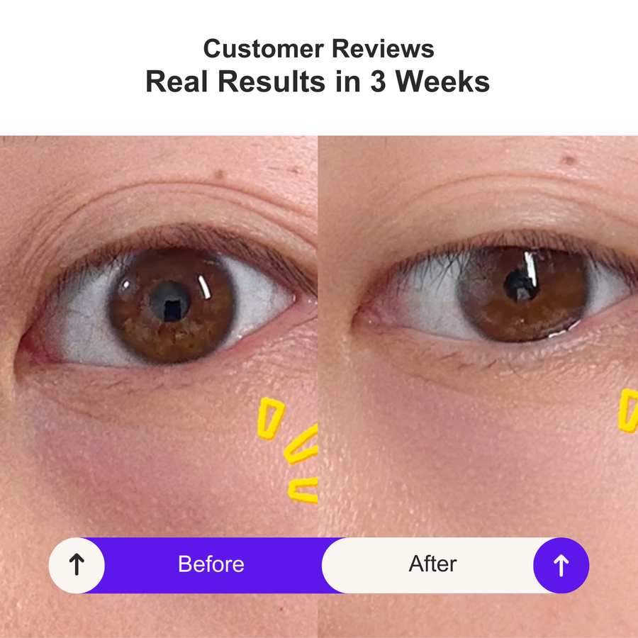 [New Launch] Swissvita Retinol Renewal Eye Cream (15ml)