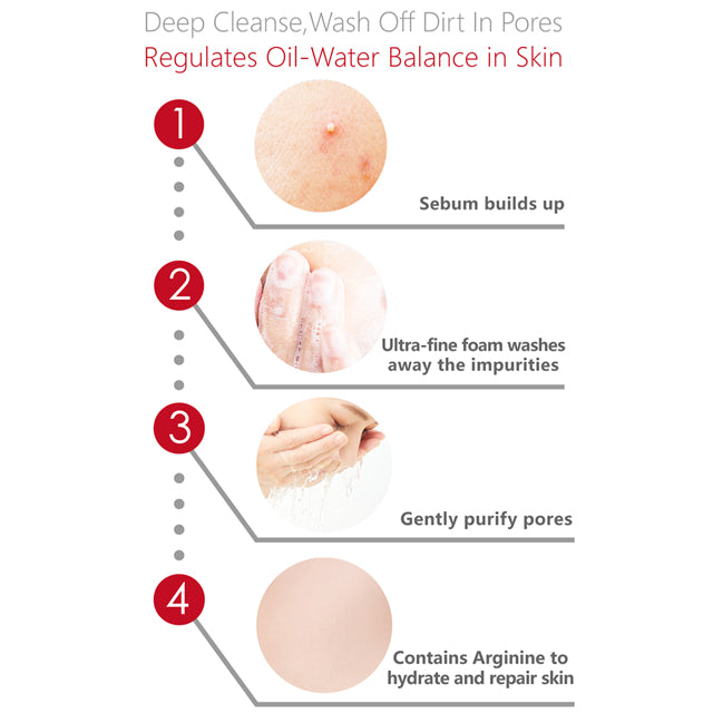 Swissvita Acne Soothing Cleanser Cream 100g