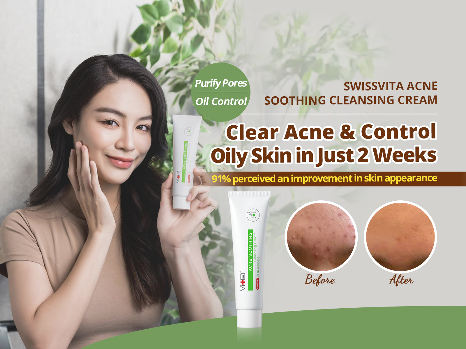 Swissvita Acne Soothing Cleanser Cream 100g