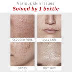 【买一送一】Swissvita Mandelic Acid Perfect Ratio Complex Serum - 30ml (VitaBtech) 薇佳蜜花酸晶焕肤美白精萃(VitaBtech升级版) 30ml