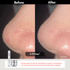 【47% OFF】Swissvita Exosome Peptide Shot (15ml)