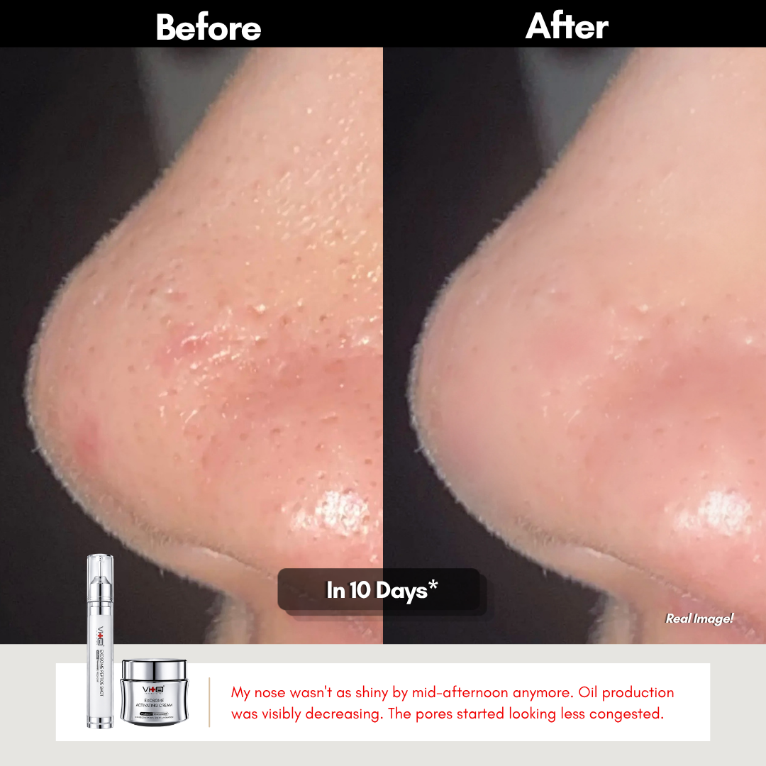 【49% OFF】Home Microneedling Set - Swissvita Exosome Peptide Shot (15ml) x 2