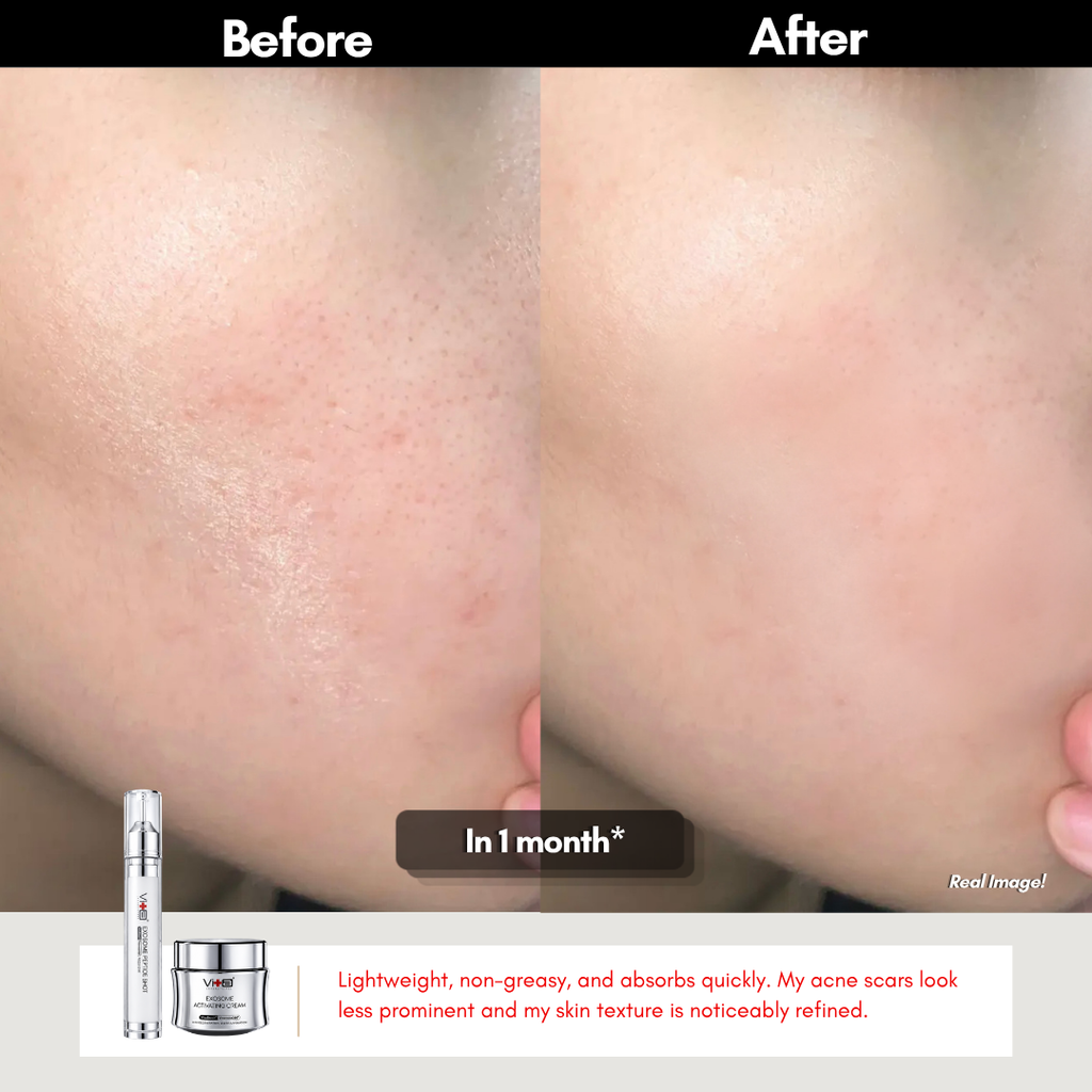 【47% OFF】Swissvita Exosome Peptide Shot (15ml)